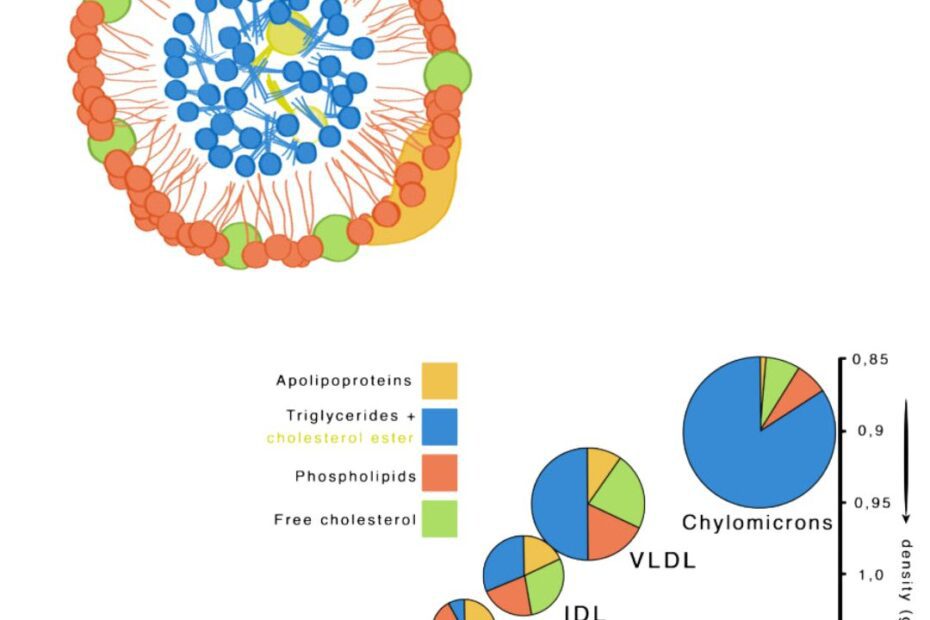 Discordance between LDL-C and LDL-Discordancia entre C-LDL y LDL-Discordance entre C-LDL et LDL